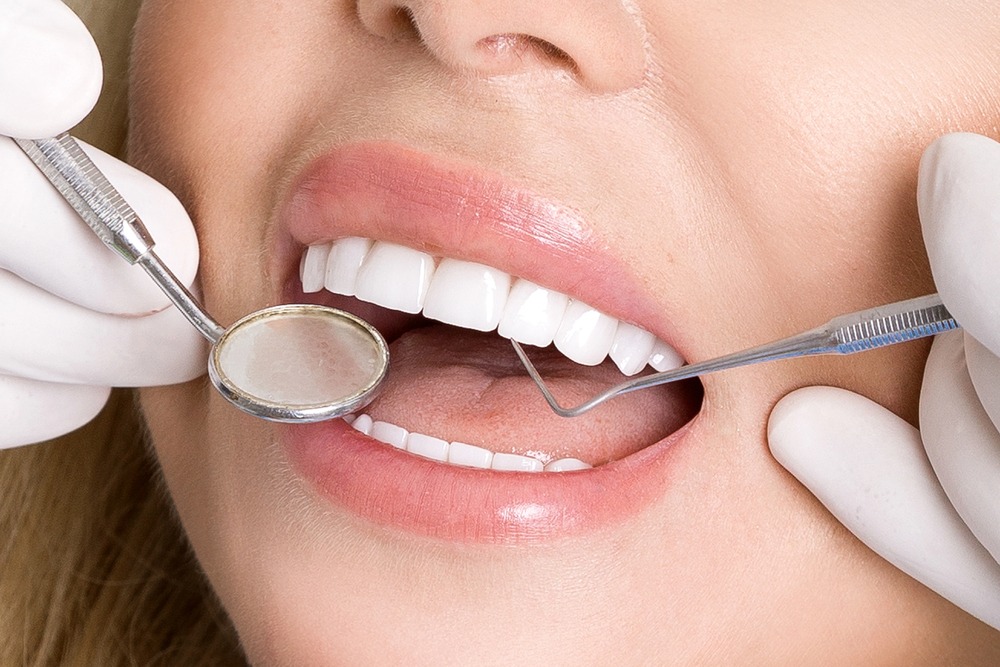 How Long Do Porcelain Veneers Last?